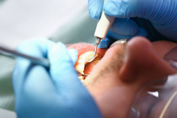Best Cosmetic Emergency Dentistry in Shelton, NE