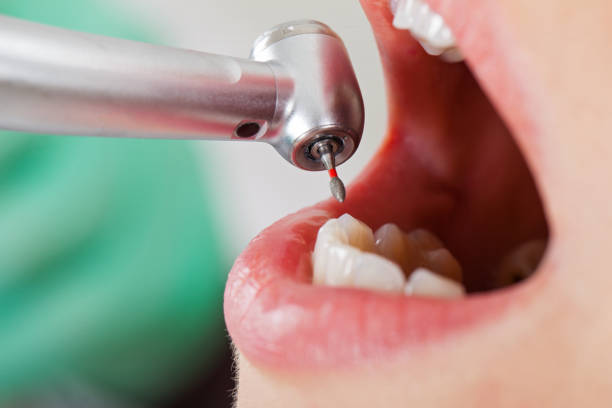 Best Emergency Treatment for Dental Infections or Abscesses in Shelton, NE